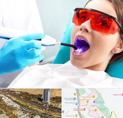 جراحی لثه با لیزر در خیابان نیایش شیراز