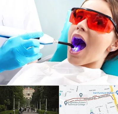 جراحی لثه با لیزر در بلوار معلم رشت 