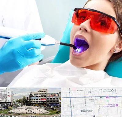 جراحی لثه با لیزر در مرکز تهران