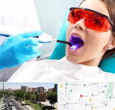 جراحی لثه با لیزر در شهرک آزمایش