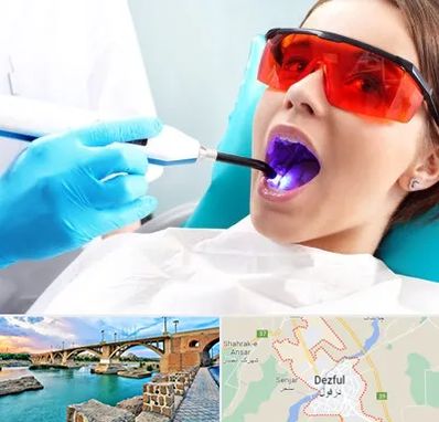 جراحی لثه با لیزر در دزفول