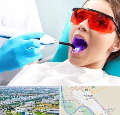جراحی لثه با لیزر در آبادان