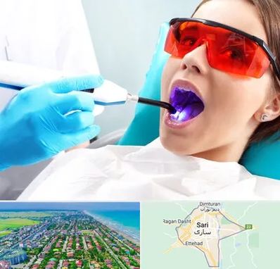 جراحی لثه با لیزر در ساری