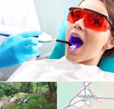 جراحی لثه با لیزر در آزادشهر