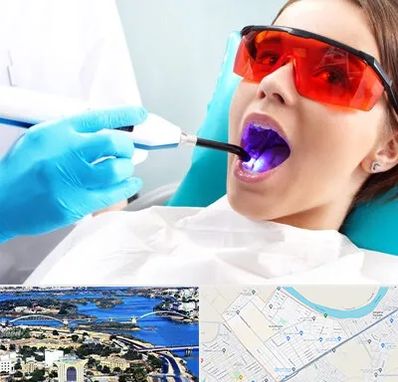 جراحی لثه با لیزر در کوروش اهواز