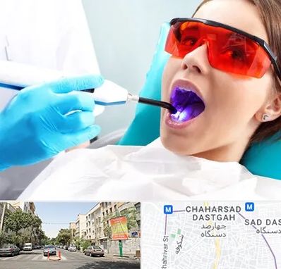 جراحی لثه با لیزر در چهارصد دستگاه 