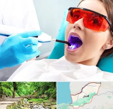 جراحی لثه با لیزر در گلستان
