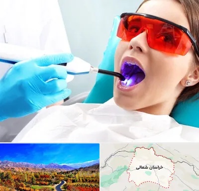 جراحی لثه با لیزر در خراسان شمالی