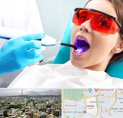 جراحی لثه با لیزر در گیشا 