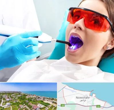 جراحی لثه با لیزر در نوشهر