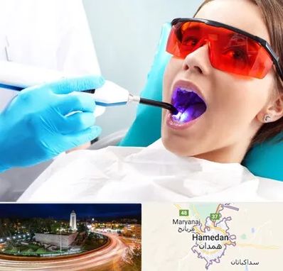 جراحی لثه با لیزر در همدان