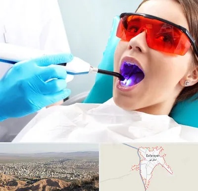 جراحی لثه با لیزر در اسفراین