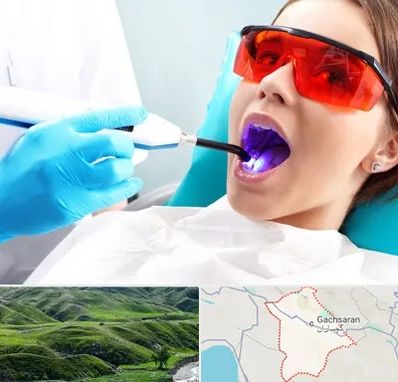 جراحی لثه با لیزر در گچساران