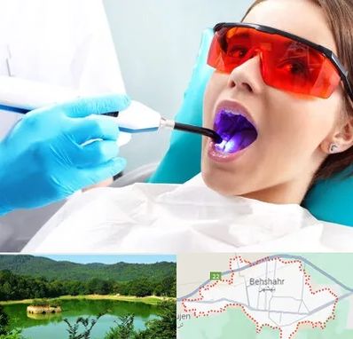 جراحی لثه با لیزر در بهشهر