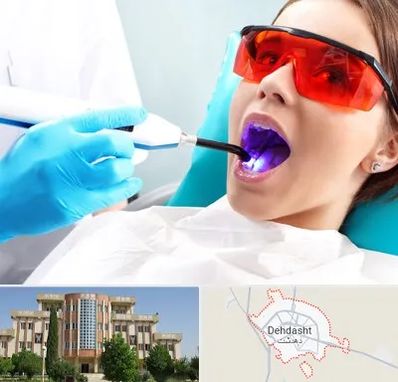 جراحی لثه با لیزر در دهدشت