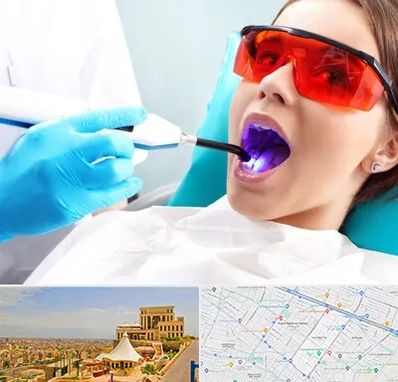 جراحی لثه با لیزر در هاشمیه مشهد