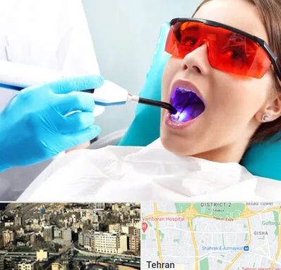 جراحی لثه با لیزر در مرزداران 