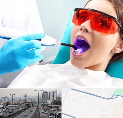 جراحی لثه با لیزر در بلوار ارتش