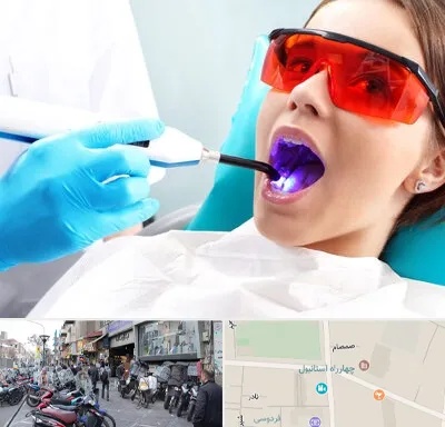 جراحی لثه با لیزر در چهارراه استانبول