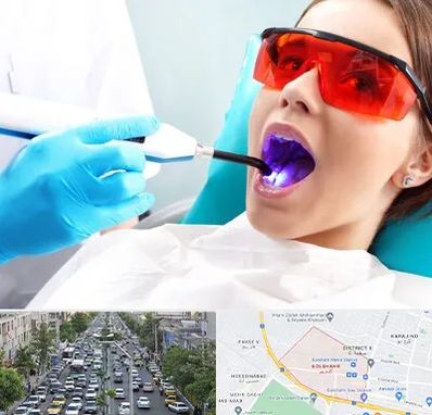 جراحی لثه با لیزر در گلشهر کرج