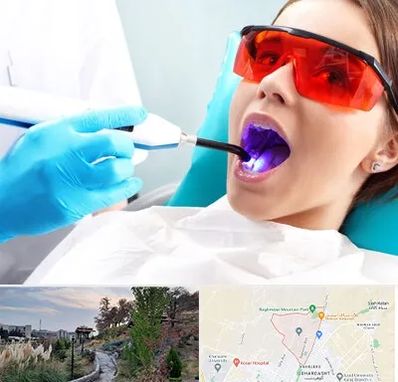 جراحی لثه با لیزر در باغستان کرج