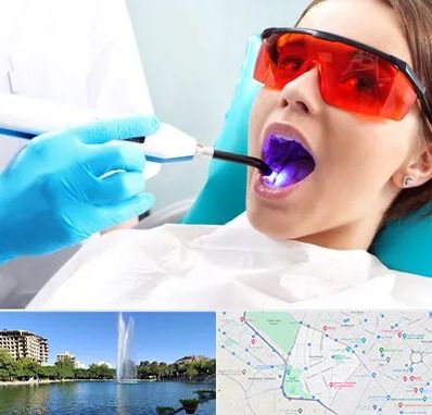 جراحی لثه با لیزر در کوهسنگی مشهد