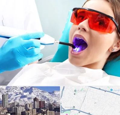 جراحی لثه با لیزر در ازگل