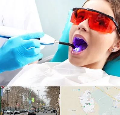 جراحی لثه با لیزر در نظرآباد کرج