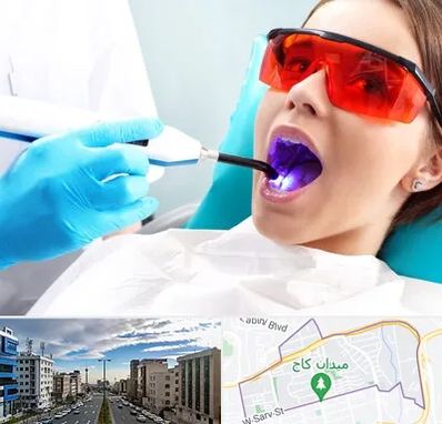 جراحی لثه با لیزر در سعادت آباد 