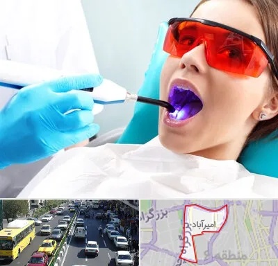 جراحی لثه با لیزر در امیرآباد