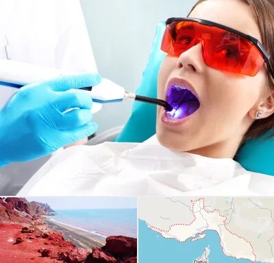 جراحی لثه با لیزر در هرمزگان