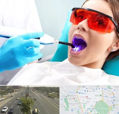 جراحی لثه با لیزر در منطقه 17 تهران