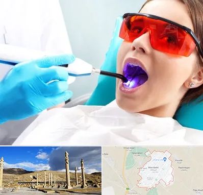 جراحی لثه با لیزر در مرودشت