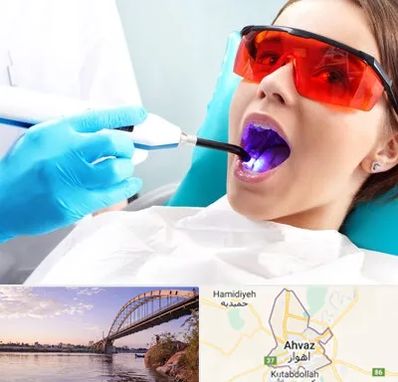 جراحی لثه با لیزر در اهواز