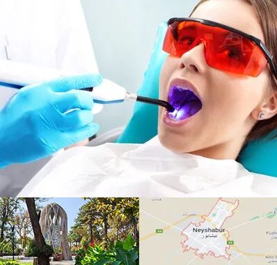 جراحی لثه با لیزر در نیشابور