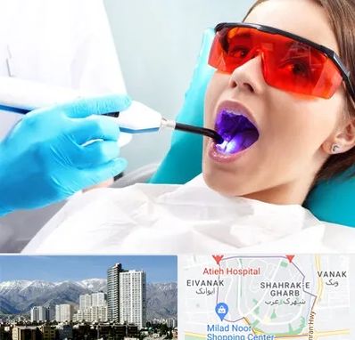 جراحی لثه با لیزر در شهرک غرب 