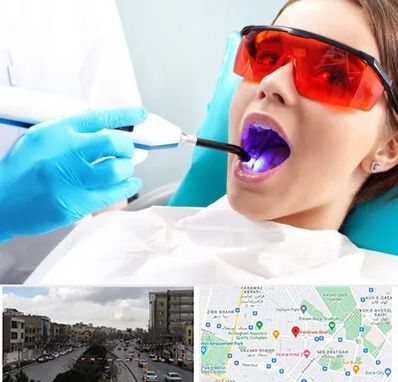 جراحی لثه با لیزر در بلوار فردوسی مشهد