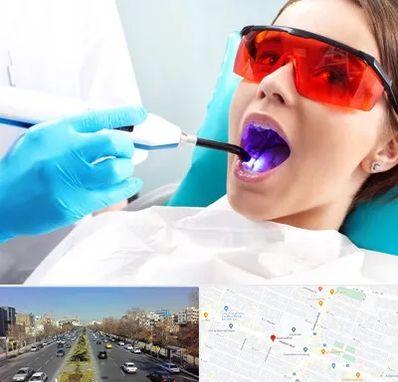 جراحی لثه با لیزر در بلوار معلم مشهد