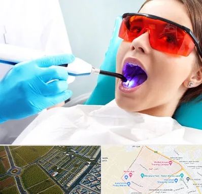 جراحی لثه با لیزر در الهیه مشهد