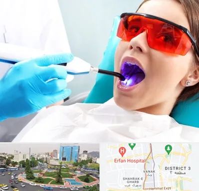 جراحی لثه با لیزر در ونک 