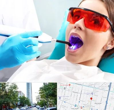 جراحی لثه با لیزر در امامت مشهد