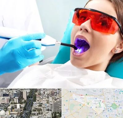 جراحی لثه با لیزر در منطقه 18 تهران