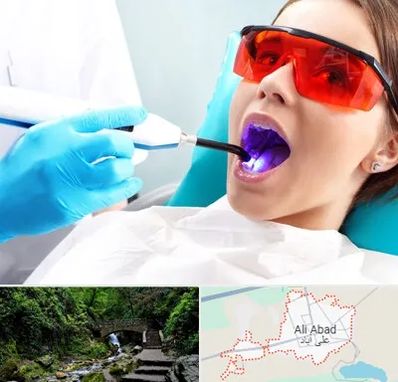 جراحی لثه با لیزر در علی آباد کتول