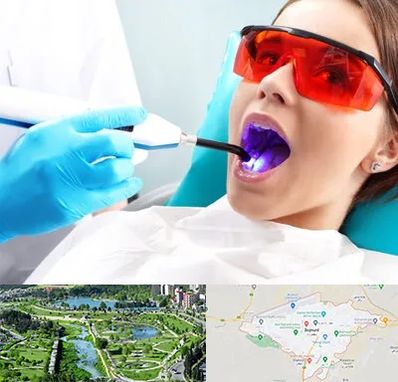 جراحی لثه با لیزر در بجنورد