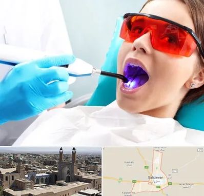 جراحی لثه با لیزر در سبزوار