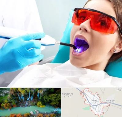 جراحی لثه با لیزر در دورود