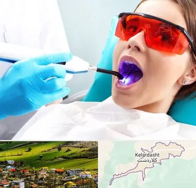 جراحی لثه با لیزر در کلاردشت