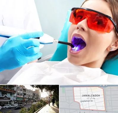 جراحی لثه با لیزر در خیابان جمالزاده