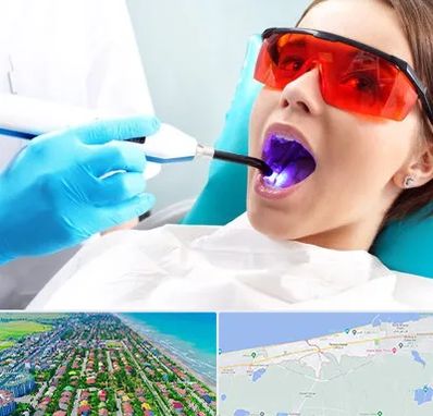 جراحی لثه با لیزر در فریدونکنار