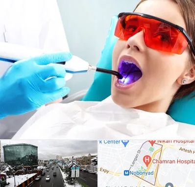 جراحی لثه با لیزر در اقدسیه 